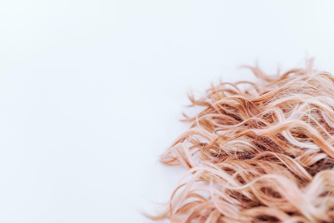 Hair loss is a prevalent issue that affects numerous individuals, and it can be attributed to a variety of factors. (RDNE Stock project/ Pexels)