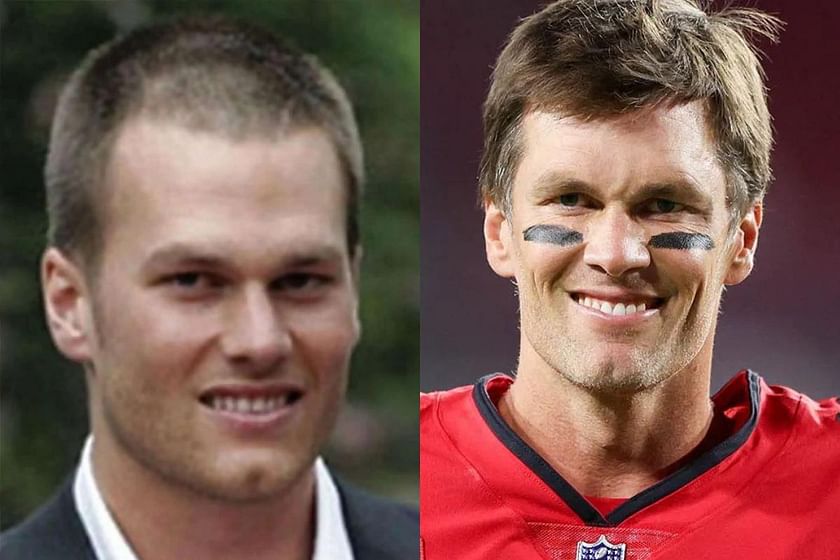 Tom Brady's hair is super – Hartford Courant