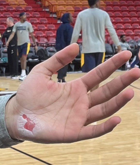 Jamal Murray hand injury update: Nuggets guard dealing with
