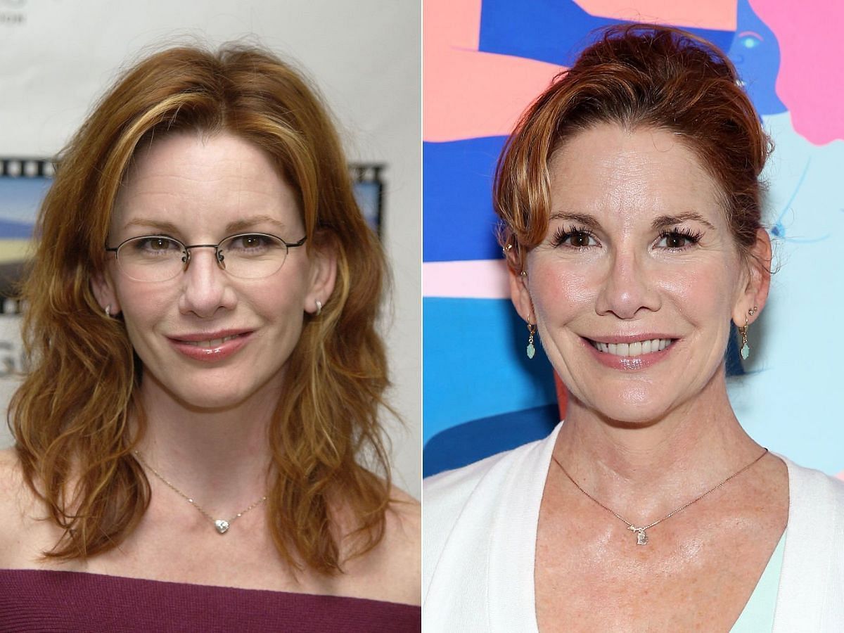 Stills of Melissa Gilbert before (left) and after (right) plastic surgery (Images Via Getty Images)