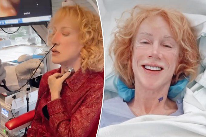 Kathy Kathy Griffin Health Update Battle With Paralyzed Vocal Cord And Lung Cancer 6792