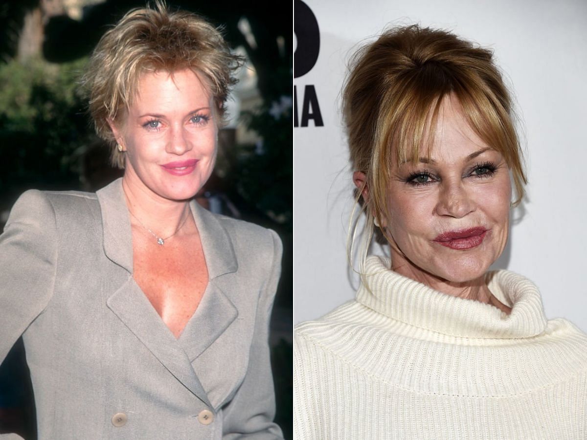 Stills of Melanie Griffith before (left) and after (right) plastic surgery (Images Via Getty Images)
