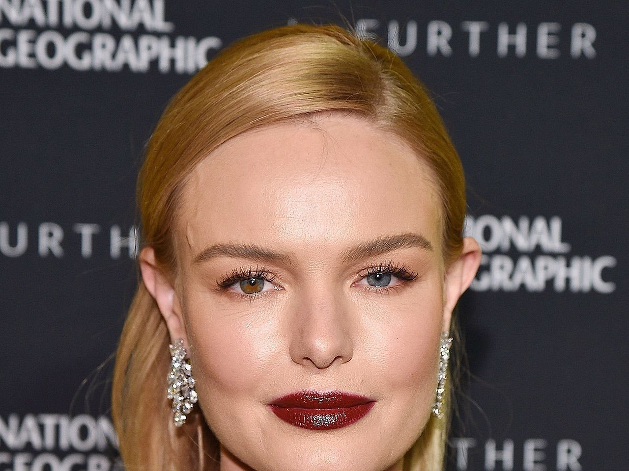 Kate Bosworth gracefully embraces and celebrates her distinctive eye coloration. (Getty Images)
