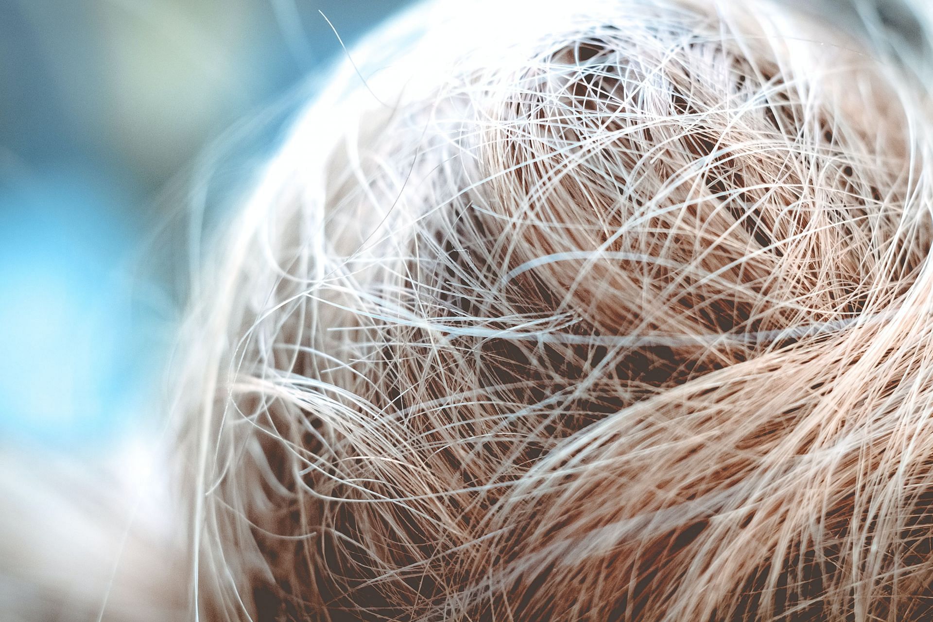 Dry dandruff is among the most common types of dandruff. (Image via Unsplash/ Niklas Hamann)