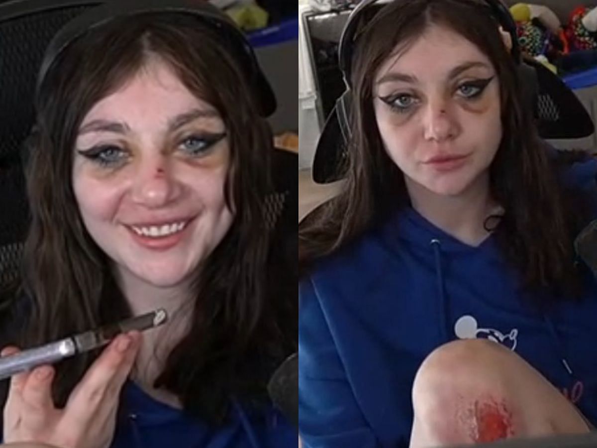 Fans concerned after JustAMinx streams with two black eyes
