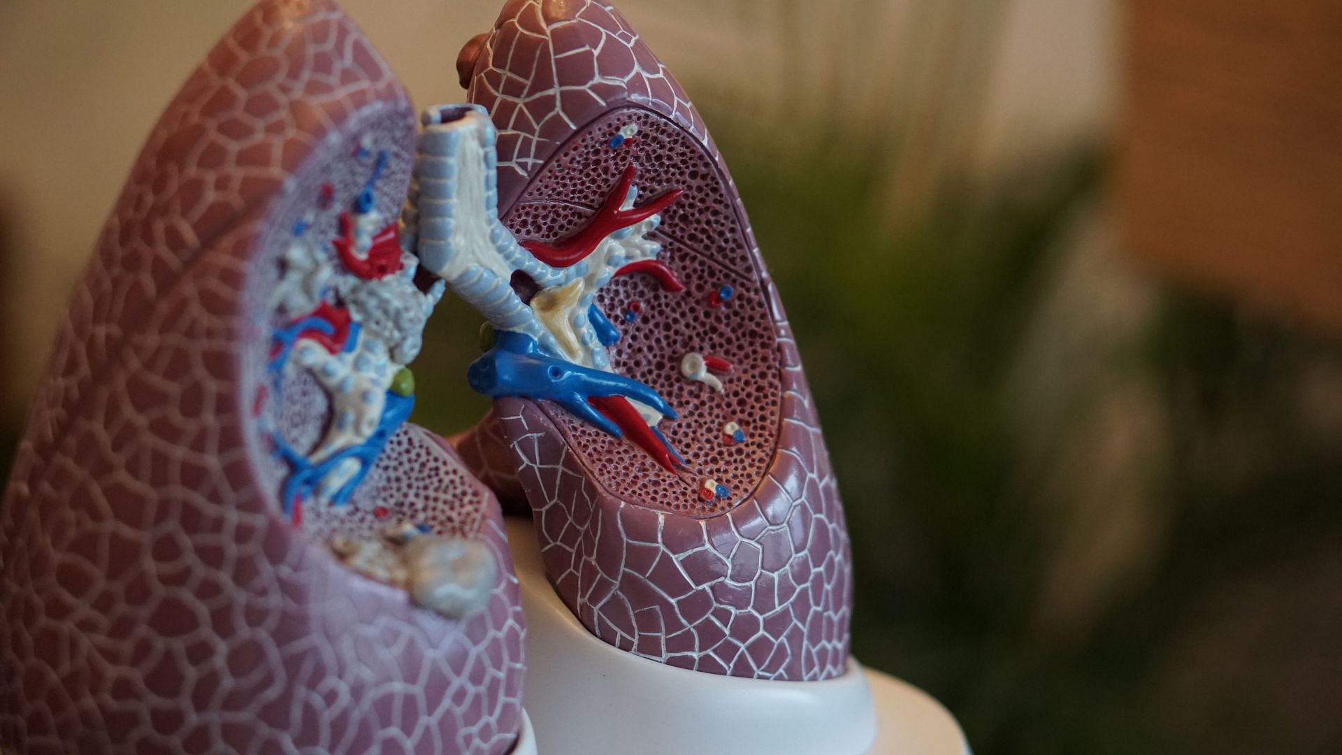 Pleurisy is an inflammatory lung condition (Image via Unsplash/Robina Weermeijer)