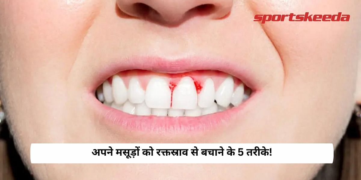 5 ways to protect your gums from Bleeding! 