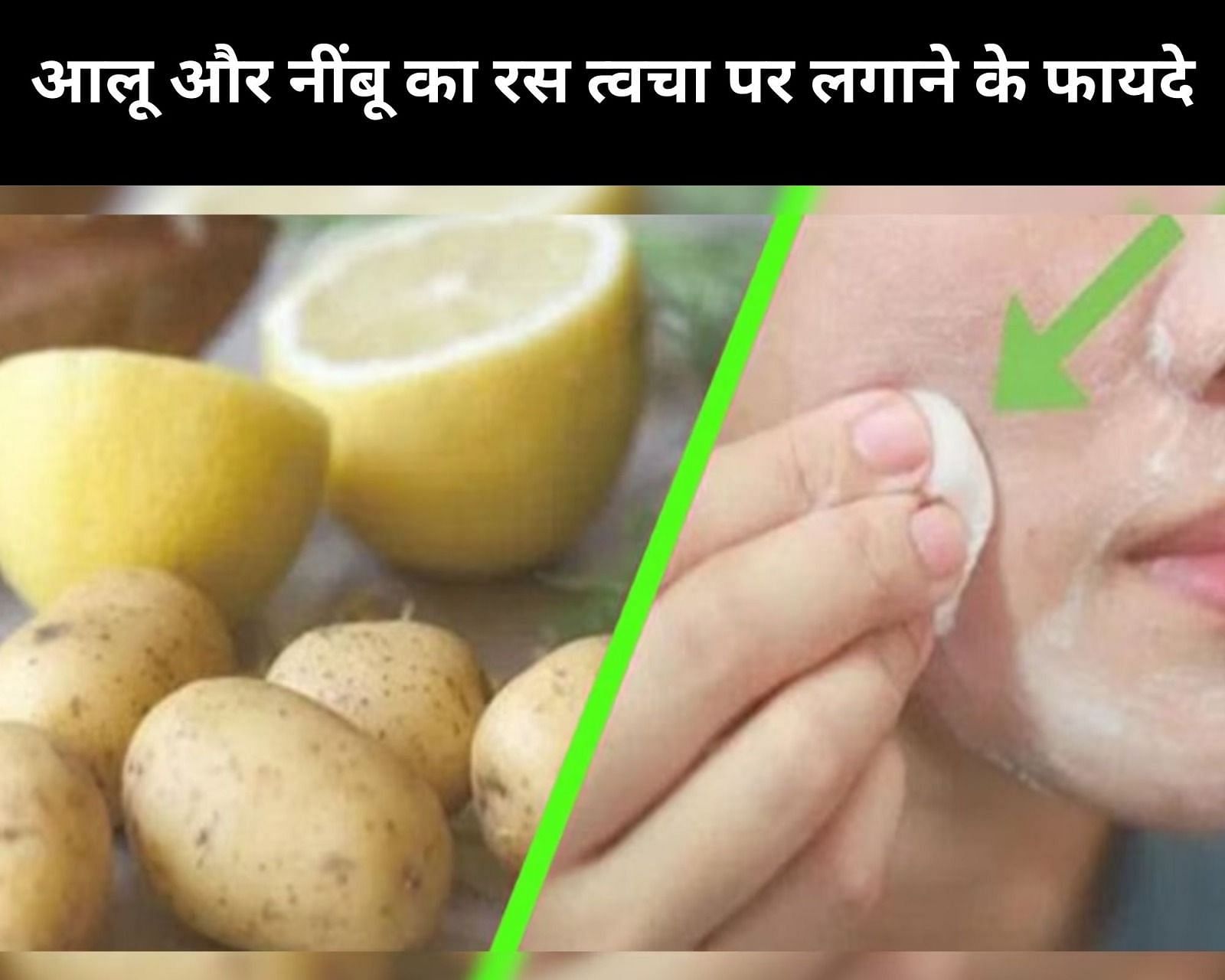 आलू और नींबू का रस त्वचा पर लगाने के फायदे (फोटो - sportskeeda hindi)