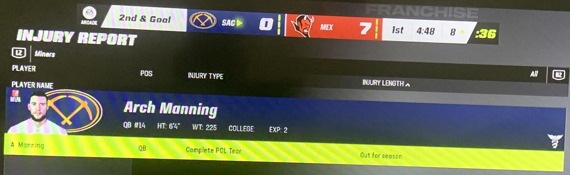A Reddit user shared a season-ending injury to one of his players in Madden 23&#039;s Franchise mode. (Image credit: Specialist_Will9067/Reddit)