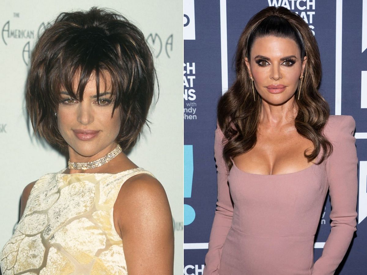 Stills of Lisa Rinna before (left) and after (right) plastic surgery (Images Via Getty Images)