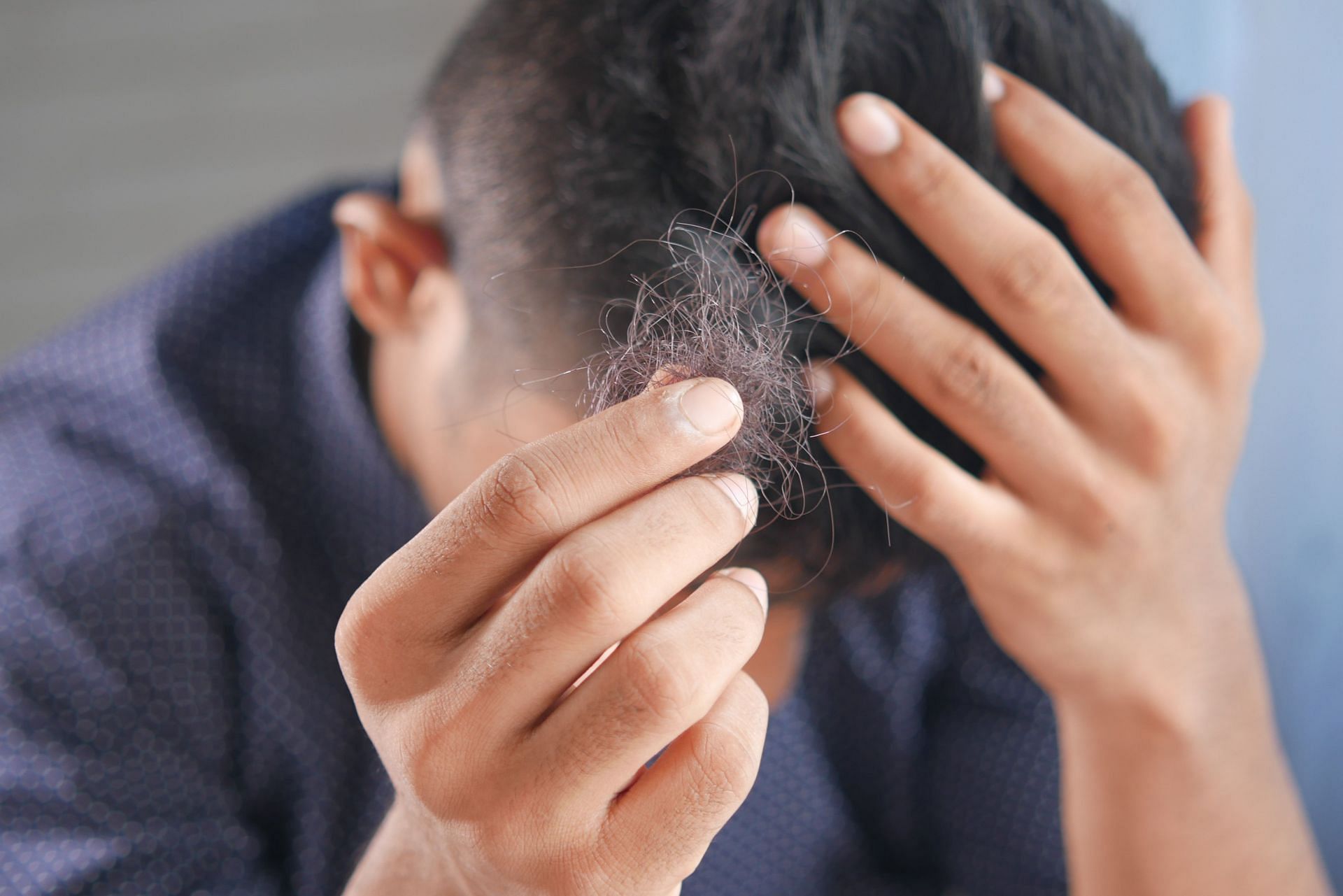 Hyperthyroidism hair loss is associated with hormonal imbalances (Image via Unsplash/Towfiqu barbhuiya)