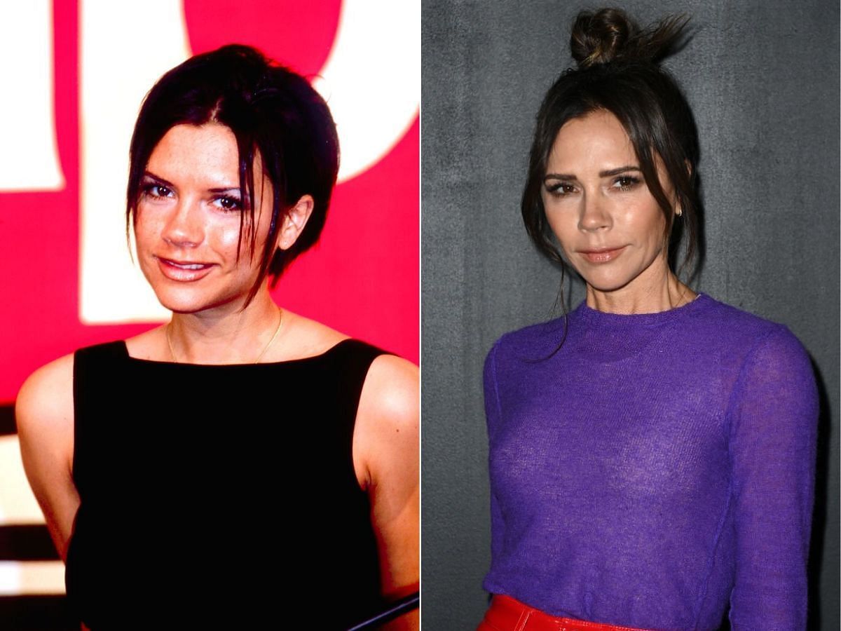 Stills of Victoria Beckham before (left) and after (right) plastic surgery (Images Via Getty Images)