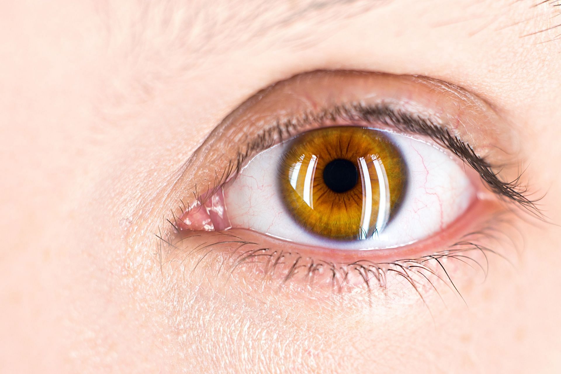 Improved eye health ( image via unsplash / Salvatore )