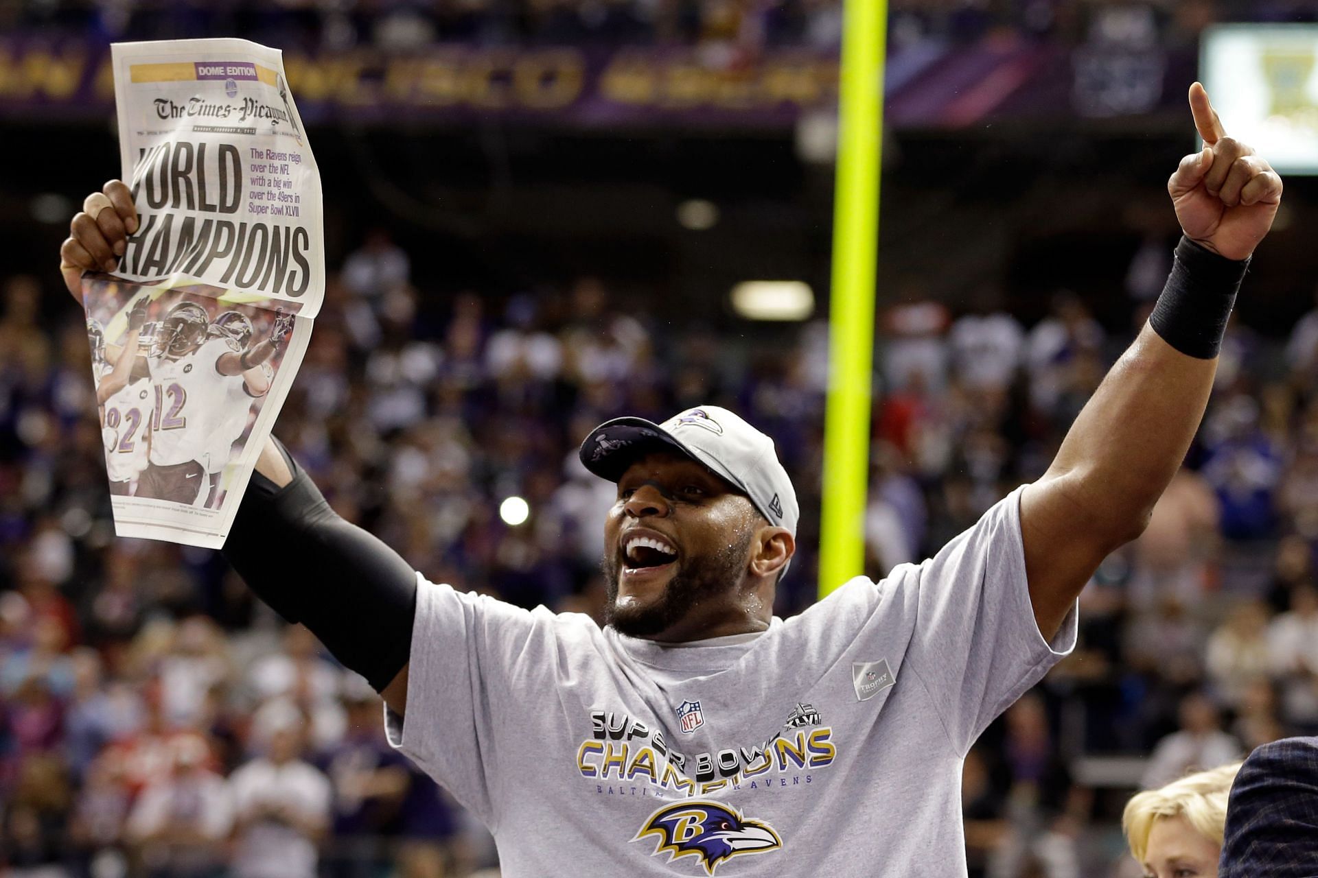 Ray Lewis goes with spray-on hairline at Super Bowl (Pictures)
