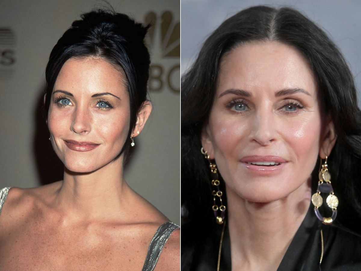 Stills of Courteney Cox before (left) and after (right) plastic surgery (Images Via Getty Images)