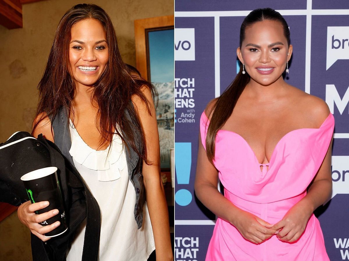 Stills of Chrissy Teigen before (left) and after (right) plastic surgery (Images Via Getty Images)