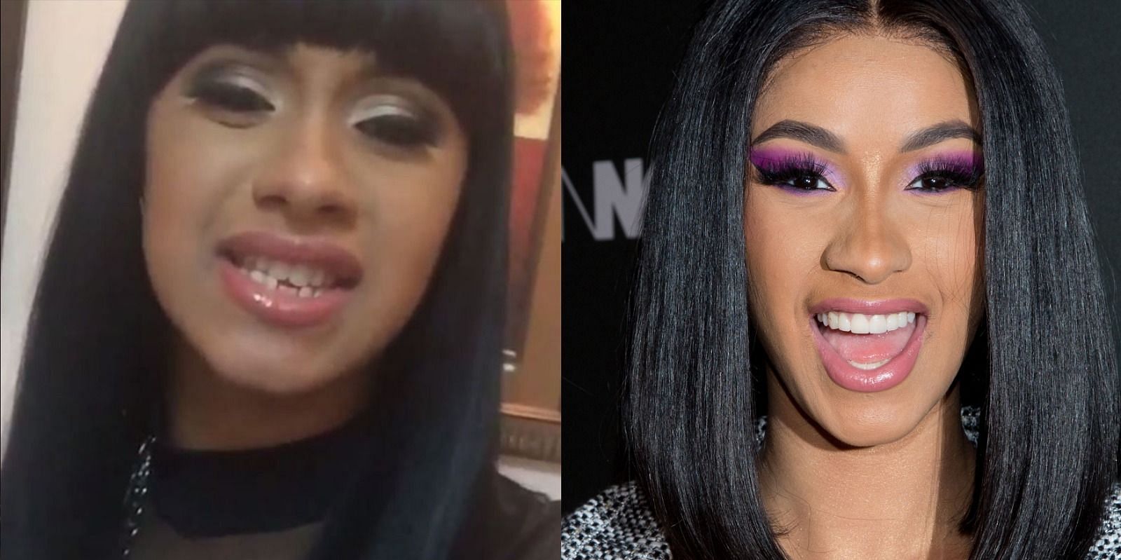 Cardi B and her dental alignment (Image via Getty)