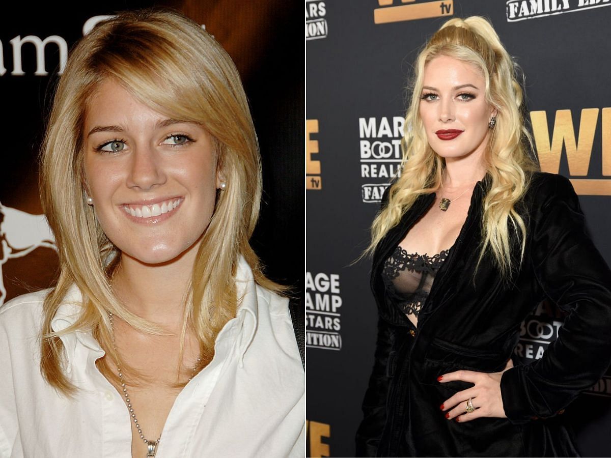 Stills of Heidi Montag before (left) and after (right) plastic surgery (Images Via Getty Images)