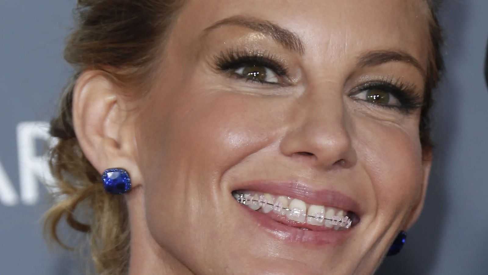 Faith Hill showing off her braces (Image via Getty Images)