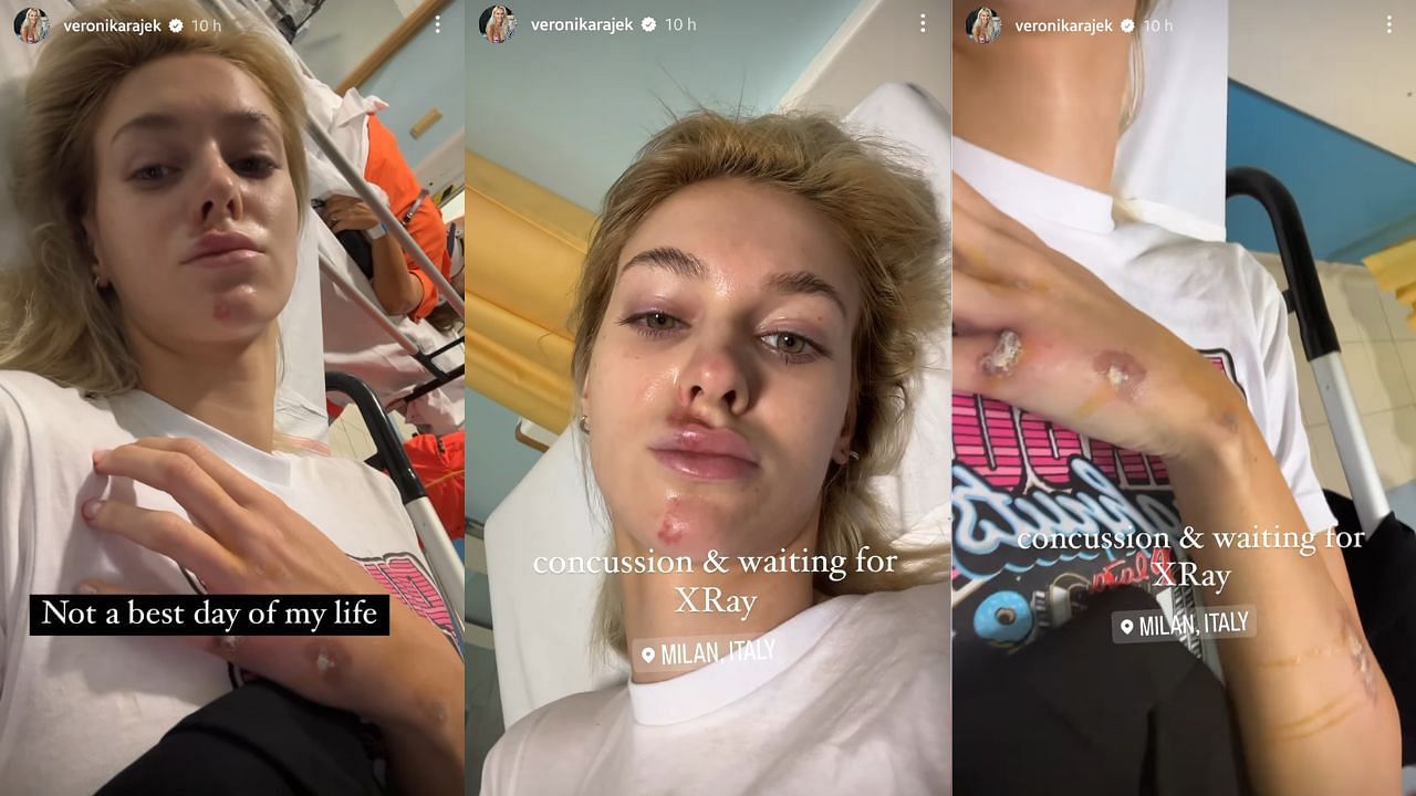 The injuries Veronika Rajek sustained after an accident in Italy (images via Instagram)