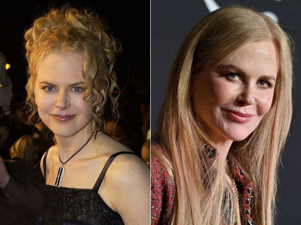 Stills of Nicole Kidman before (left) and after (right) plastic surgery (Images Via Getty Images)