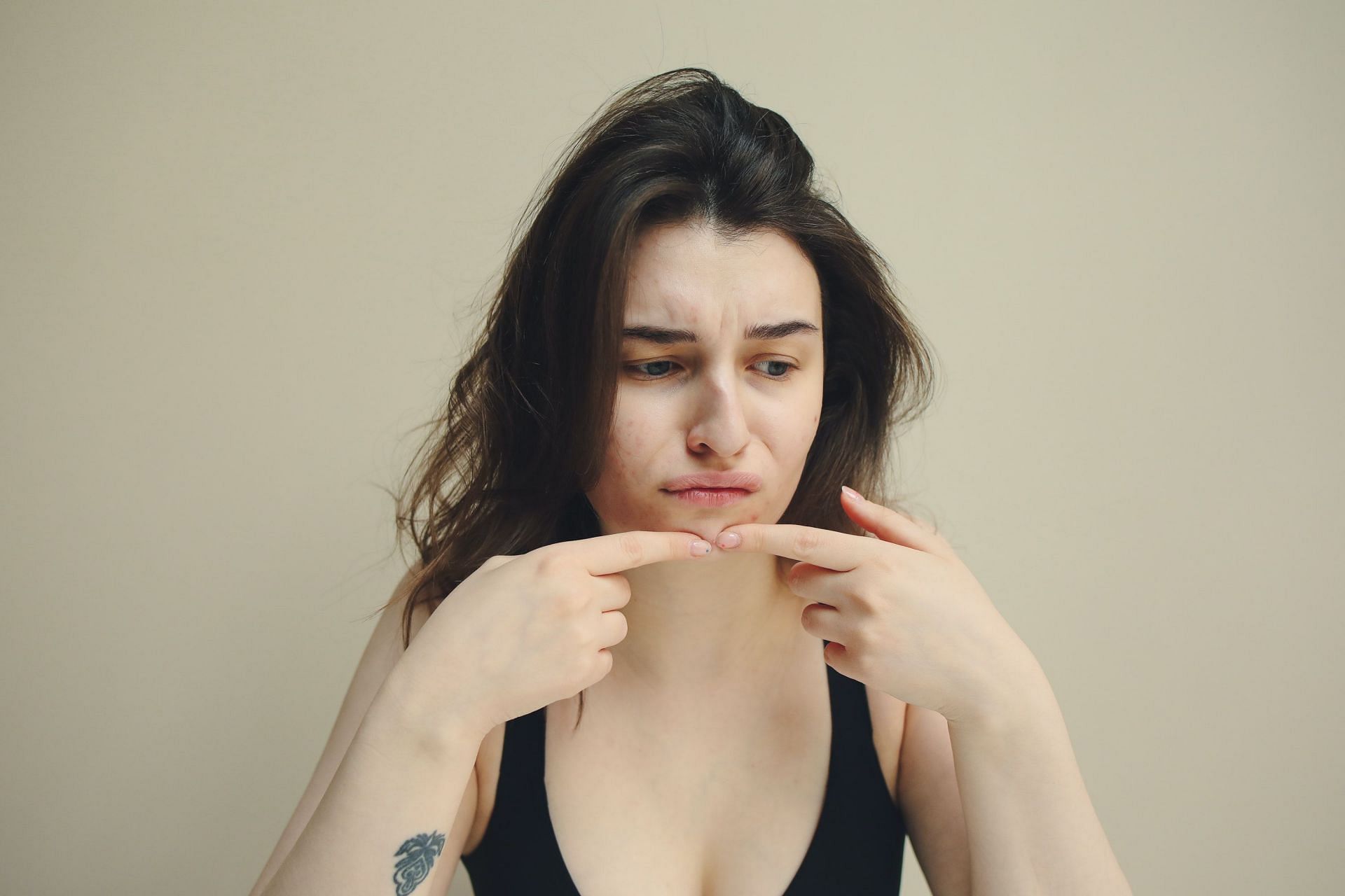 How to prevent stress pimple? (Image via Pexels / Polina Tankilevitch)