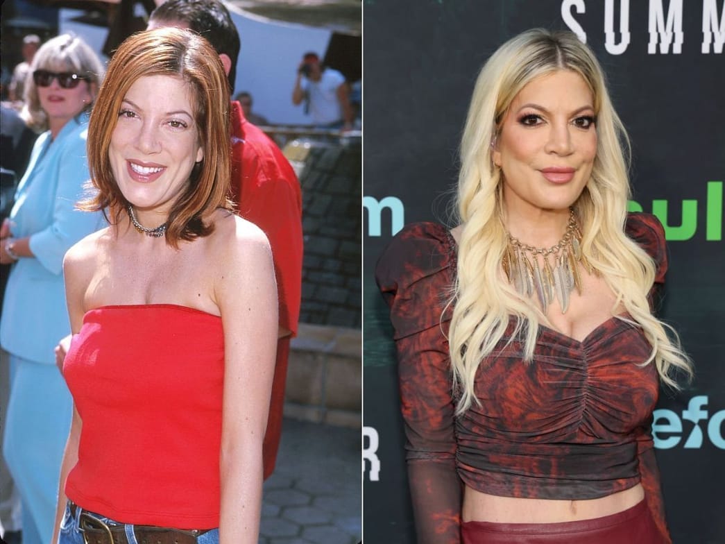 20 Female Celebs who were Unhappy with their Plastic Surgeries