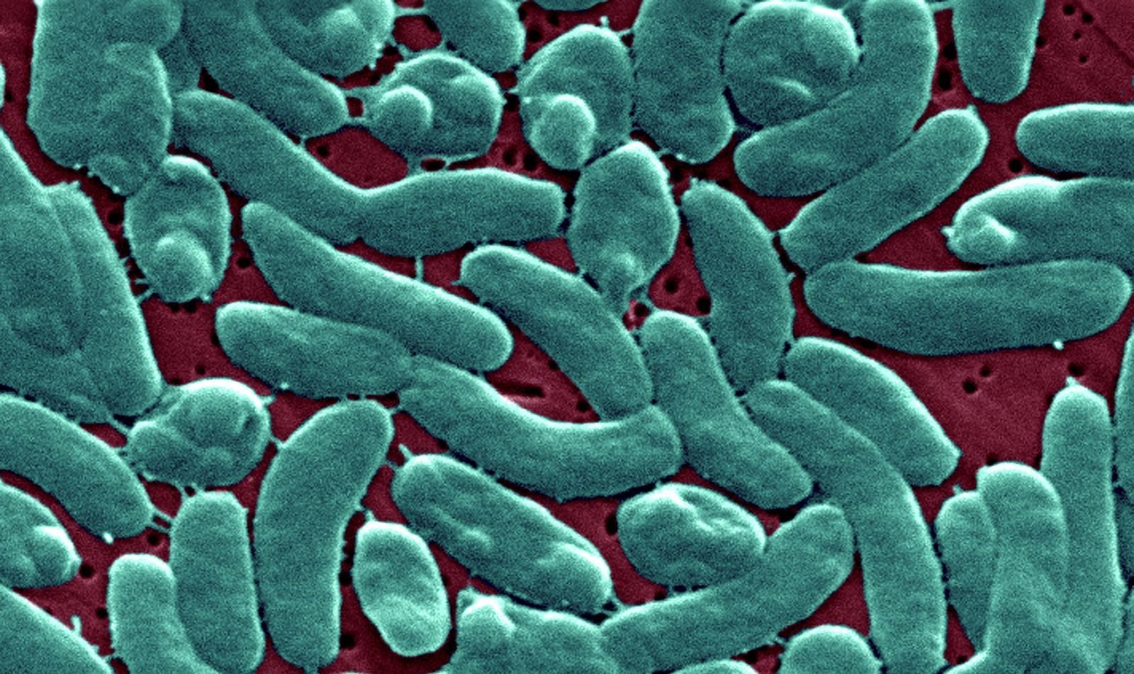 Vibrio vulnificus (Image via CNN)