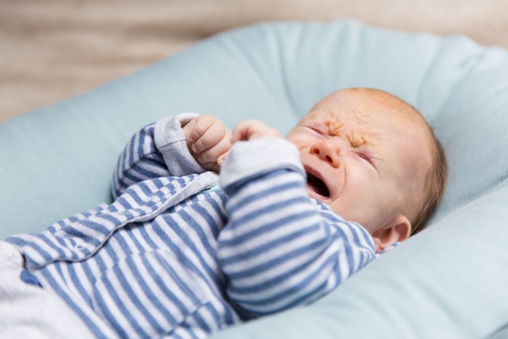 Cradle cap in newborn (Image via freepik/pch.vector)