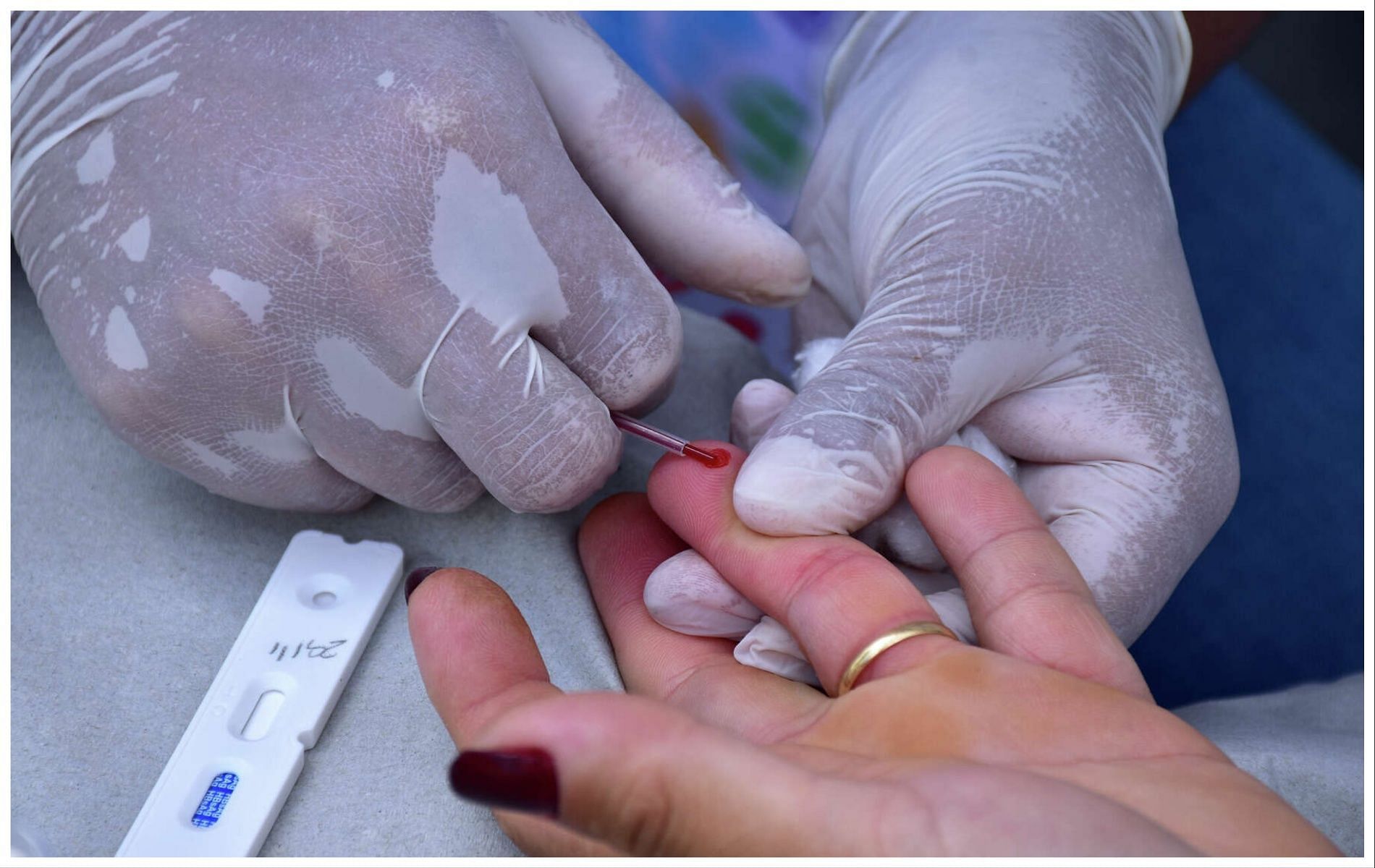 Syphilis outbreak in Houston marks 128% rise in the cases of women (Image via Chron)