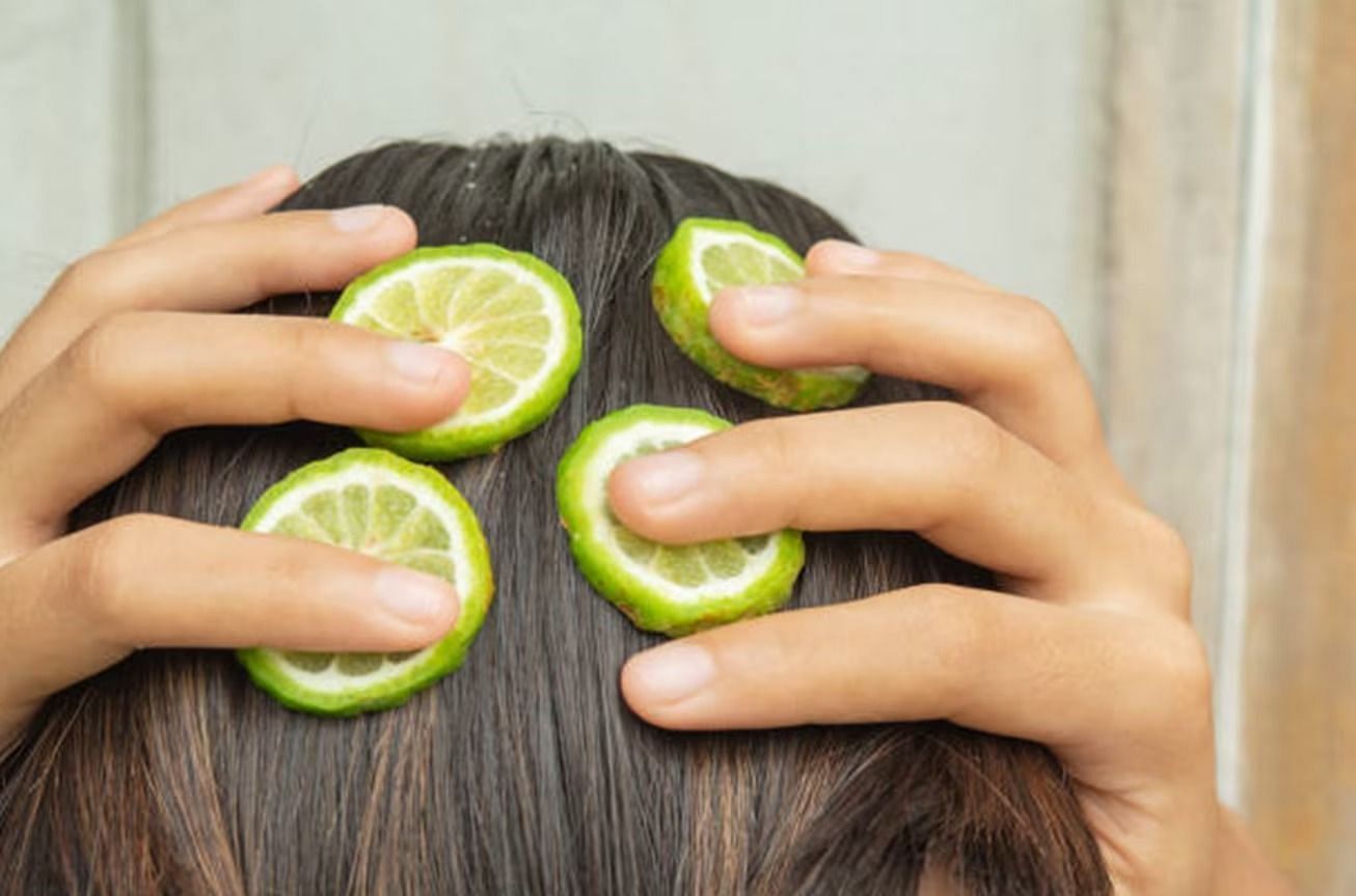 Lemon (Image via Getty Images)