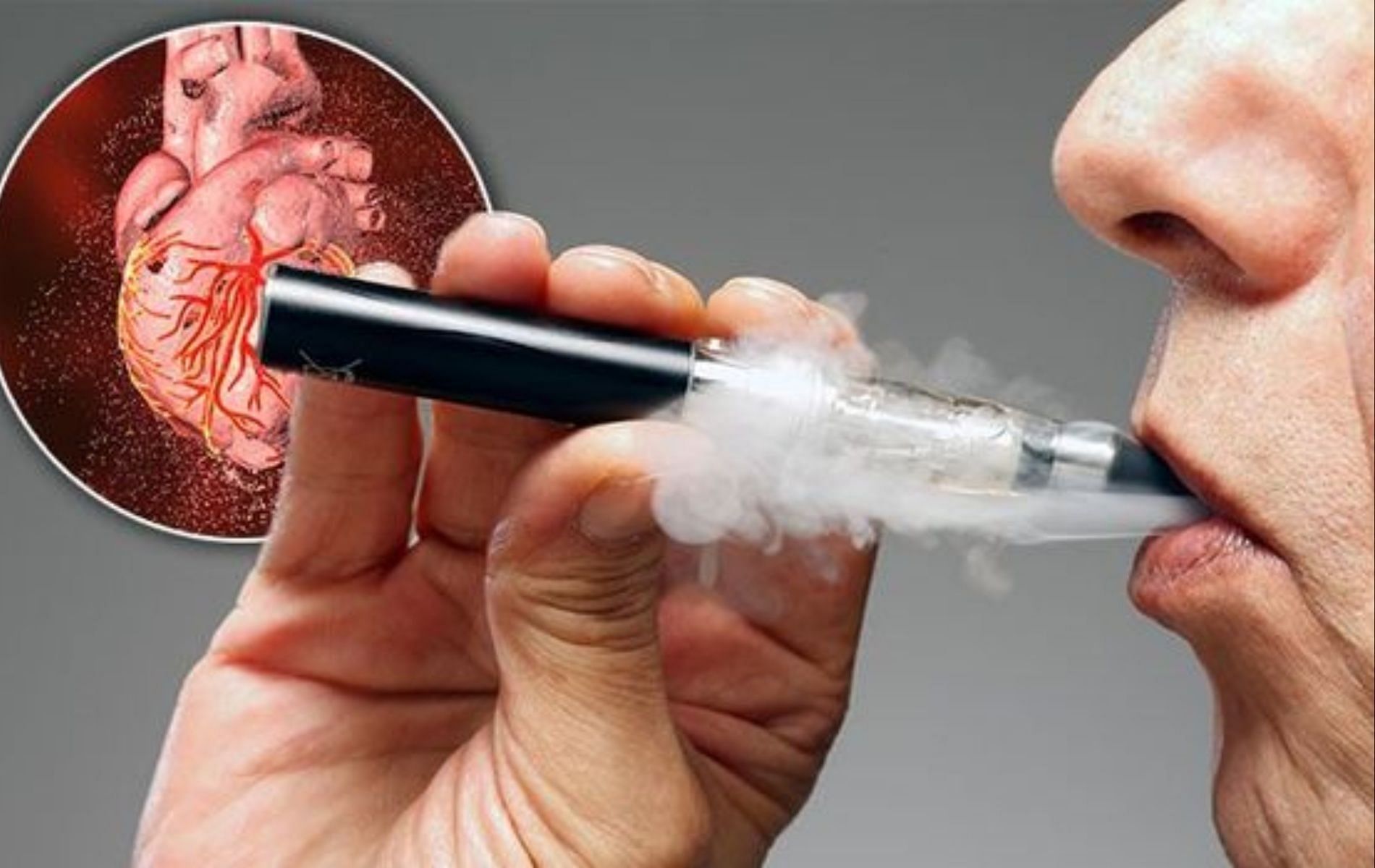New studies suggest that vaping causes heart diseases. (Image via Daily Express)