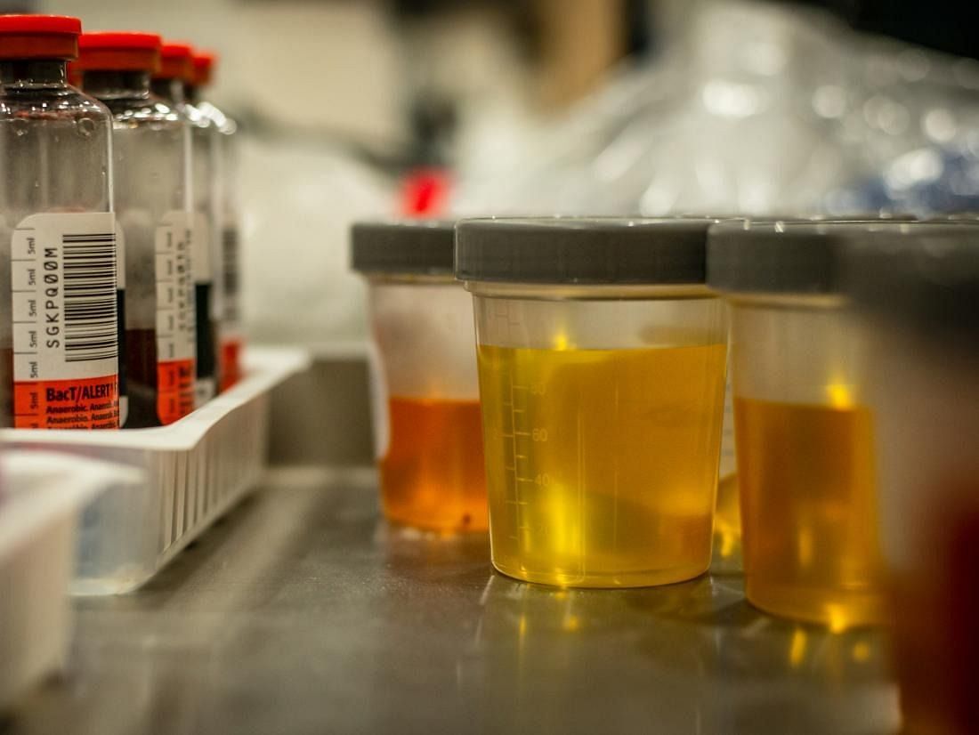 Urine Samples (Image via Getty Images)
