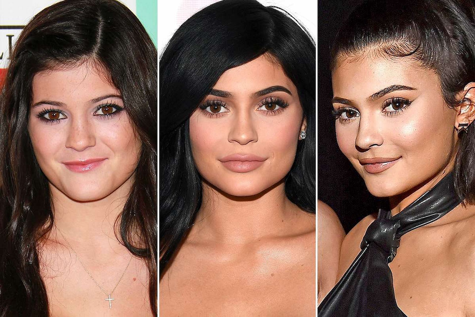 Over the years Kylie has received major backlash for surgically altering her face (Image via Getty)