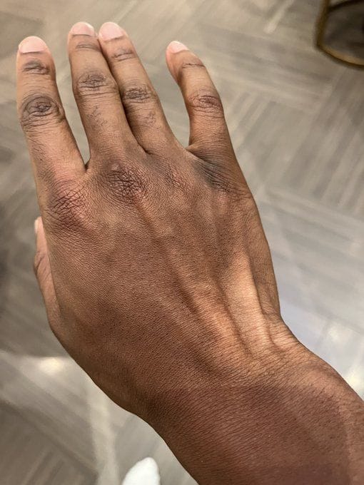 "I'm turning white" KSI responds to fans expressing concerns about