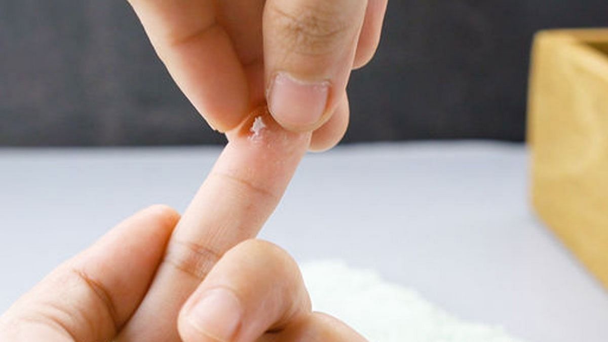 Removing super glue from skin (Image via Getty Images)
