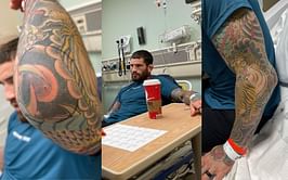 Sean Brady shows off unusually swollen elbow as he blames it on Streptococcus B for pulling out of Jack Della Maddalena fight