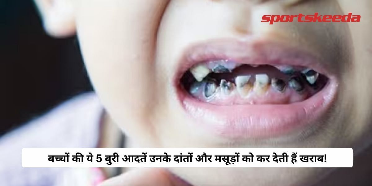 These 5 bad habits of children spoil their teeth and gums!