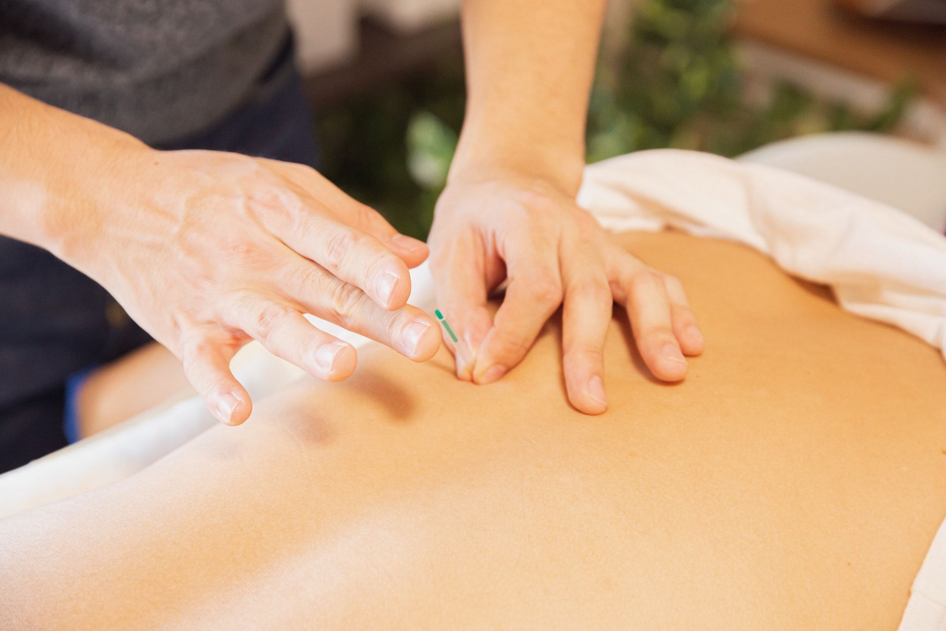 Acupuncture can help ease pain. (Photo via Pexels/Ryutaro Tsukata)