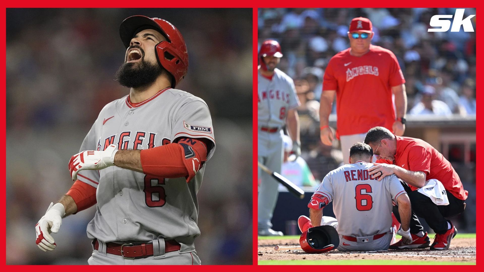 Angels' Rendon needs hip surgery, ending injury-plagued year