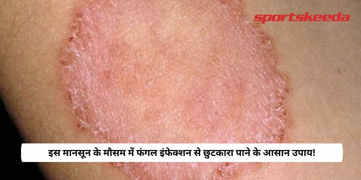 Easy ways to get rid of fungal infection in this monsoon season!