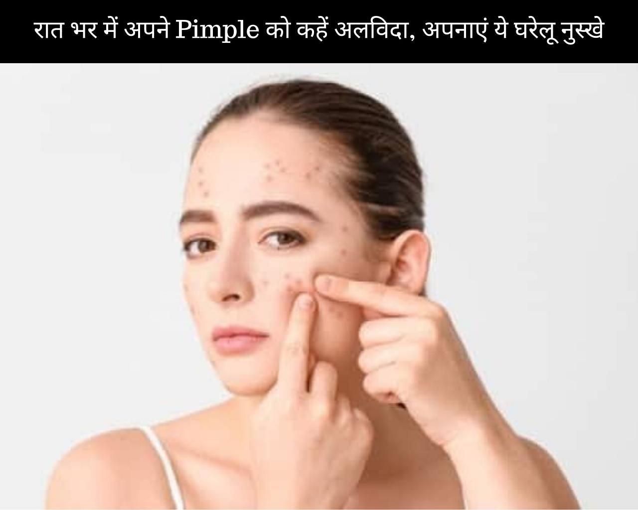 रात भर में अपने Pimple को कहें अलविदा, अपनाएं ये 7 घरेलू नुस्खे (फोटो - sportskeedaहिन्दी)