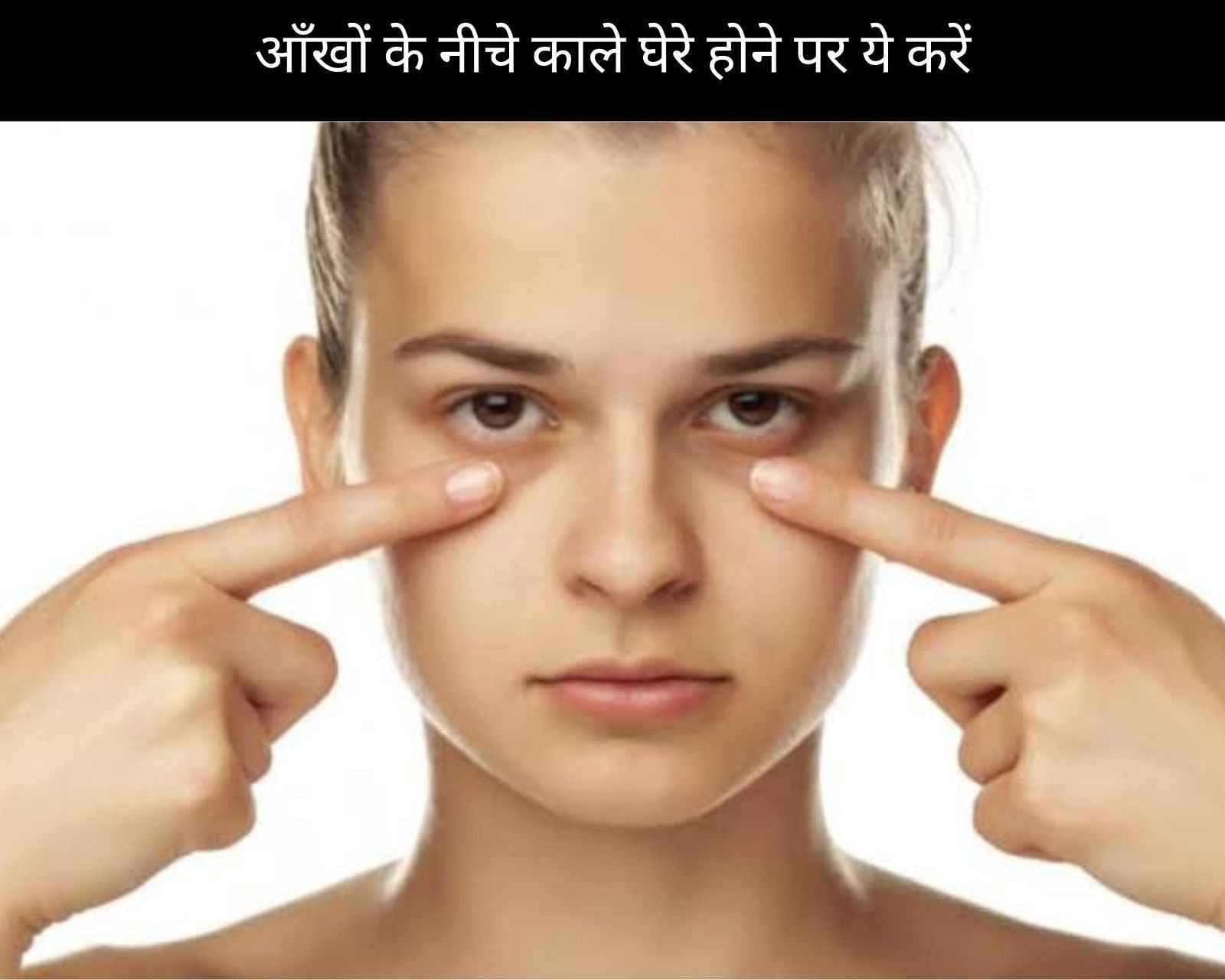 Reduce Dark Circles With These 10 Home Remedies In Hindi