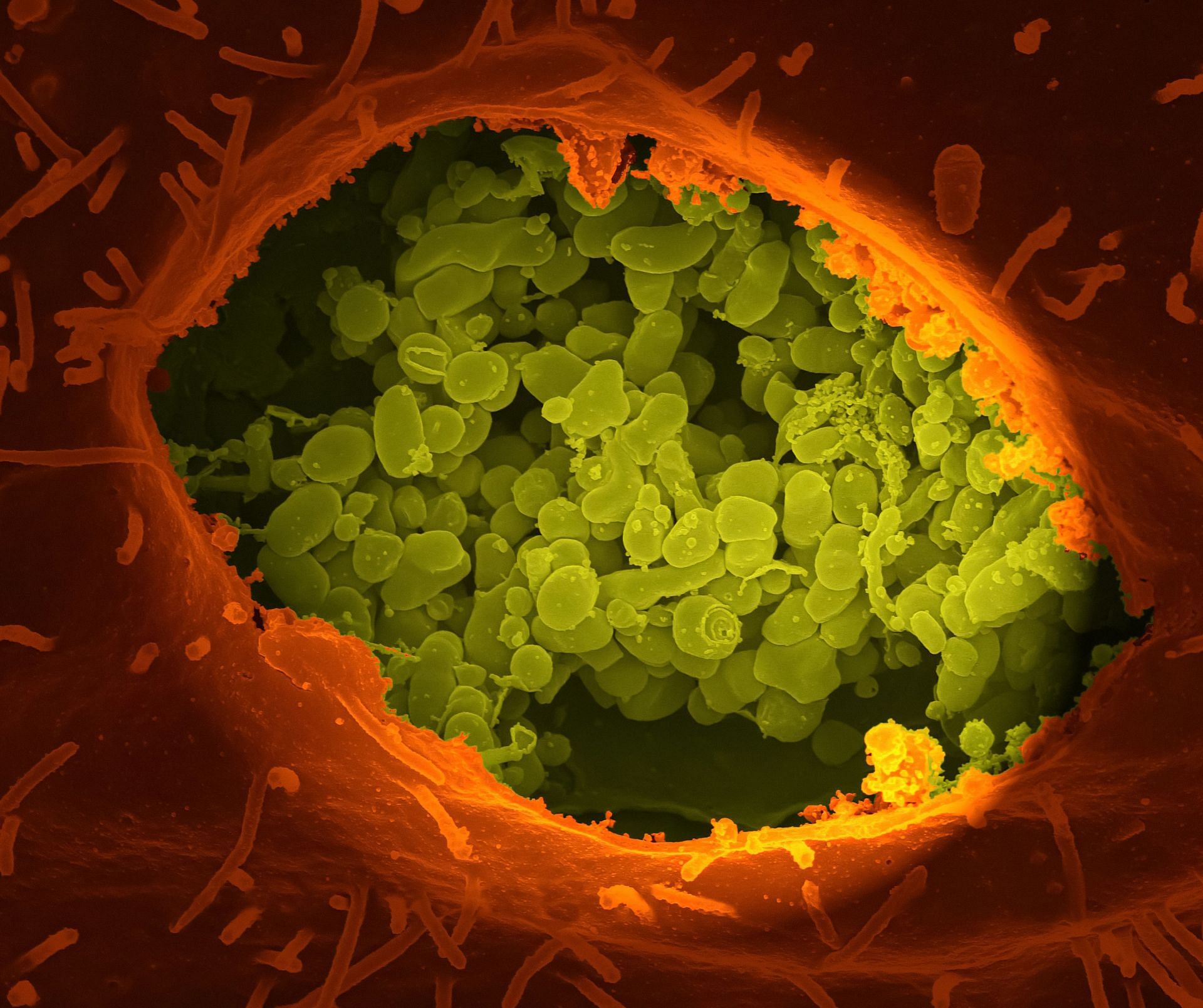 Impacts healthy gut bacteria (Image via Unsplash/CDC)