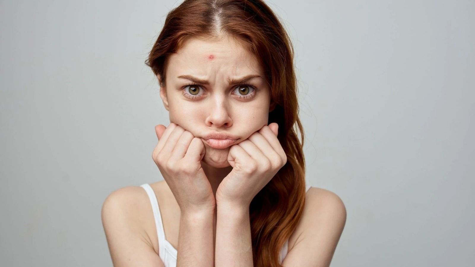 Acne on the forehead (Image via Getty Images)