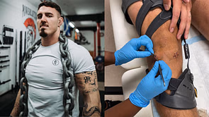 UFC heavyweight Tom Aspinall admits he was fighting "with one leg and still winning" ahead of freak injury against Curtis Blaydes