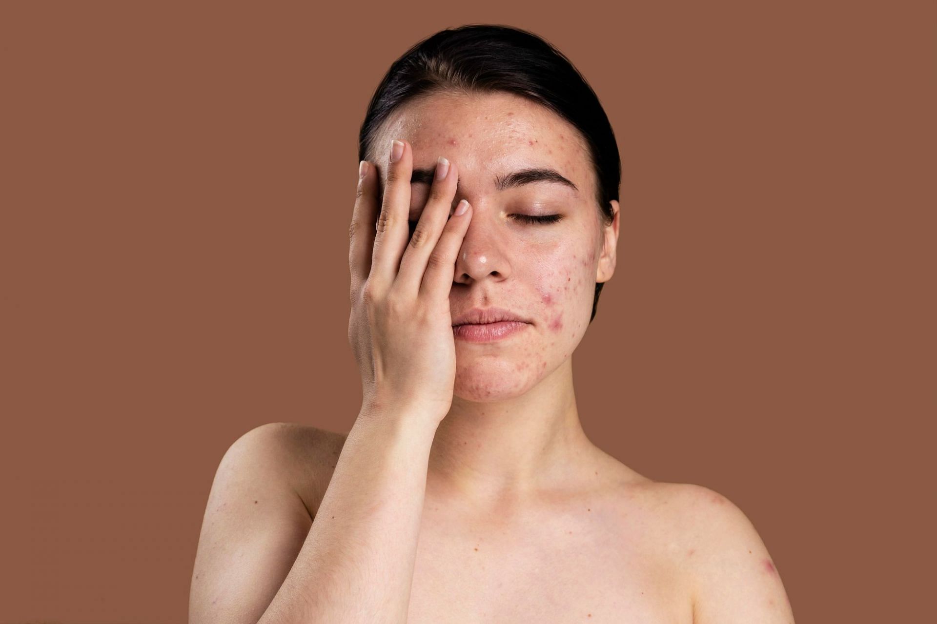 Toxic mold can lead to skin problems. (Photo via Freepik)