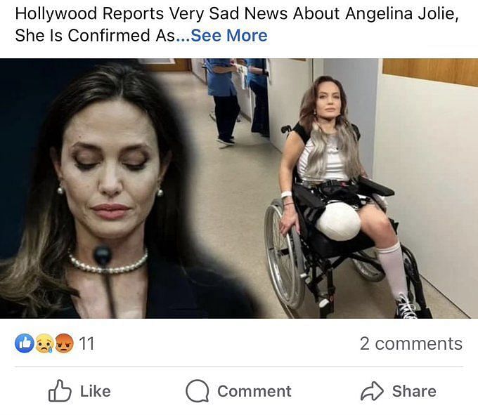 Fact Check Is Angelina Jolie missing a leg? Viral picture debunked