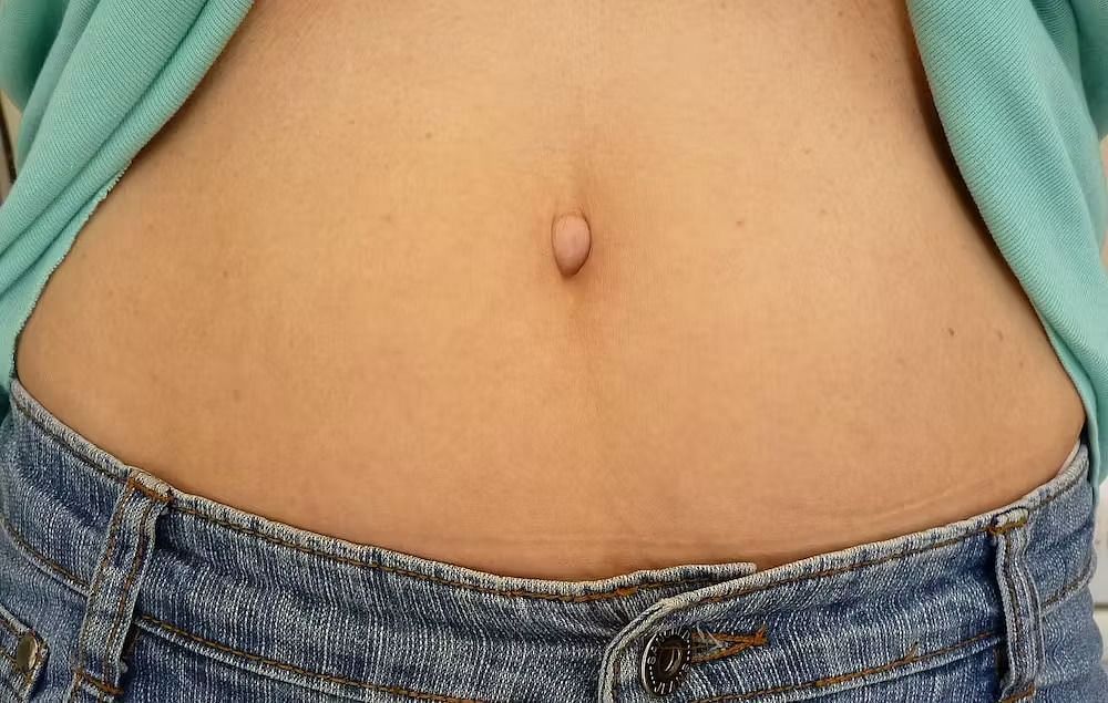 Outie belly button (Image via Getty Images)