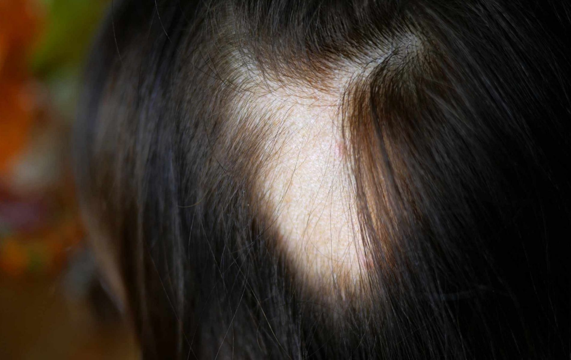 EGCG contained in greentea can help prevent hormonal hair loss. (Image via GettyImages)